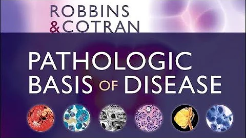 Evasion of Immune Surveillance in Cancer | Chapter 7 | ROBBINS PATHOLOGY Based Audio Podcast