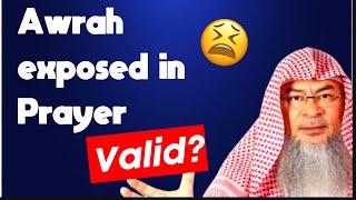 Shirt went up & awrah was exposed in prayer, is my prayer valid? | Sheikh Assim Al Hakeem -JAL screenshot 3