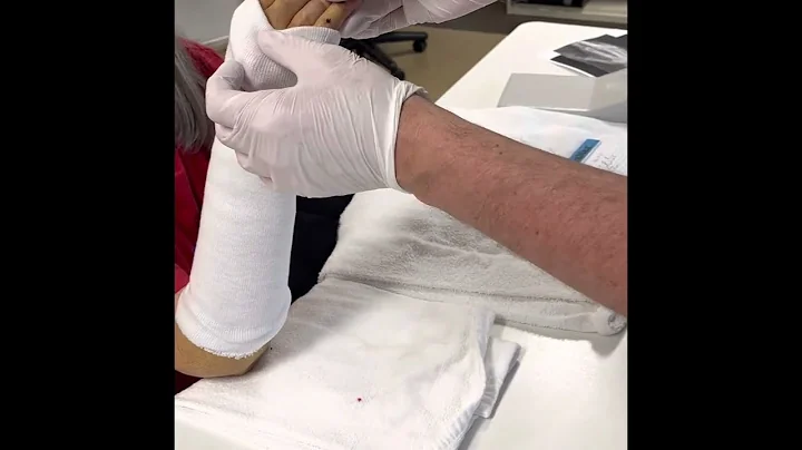 Ulnar gutter orthosis