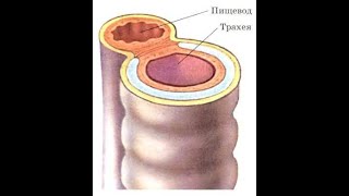 Тиннитус. Шум в голове, ушах. Почему не лечится. Как с этим жить. Часть 63. Регулярка. Дополнительно