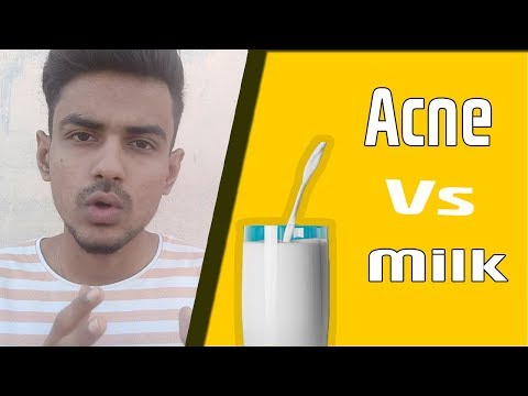 Does milk cause acne? | Hindi [ हिंदी ]