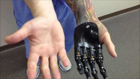 I-digits from Touch Bionics