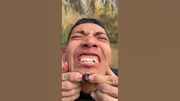 How I Cured a Bug Bite with Yogurt in the Wild | Survival Hacks🤯😅😵‍💫