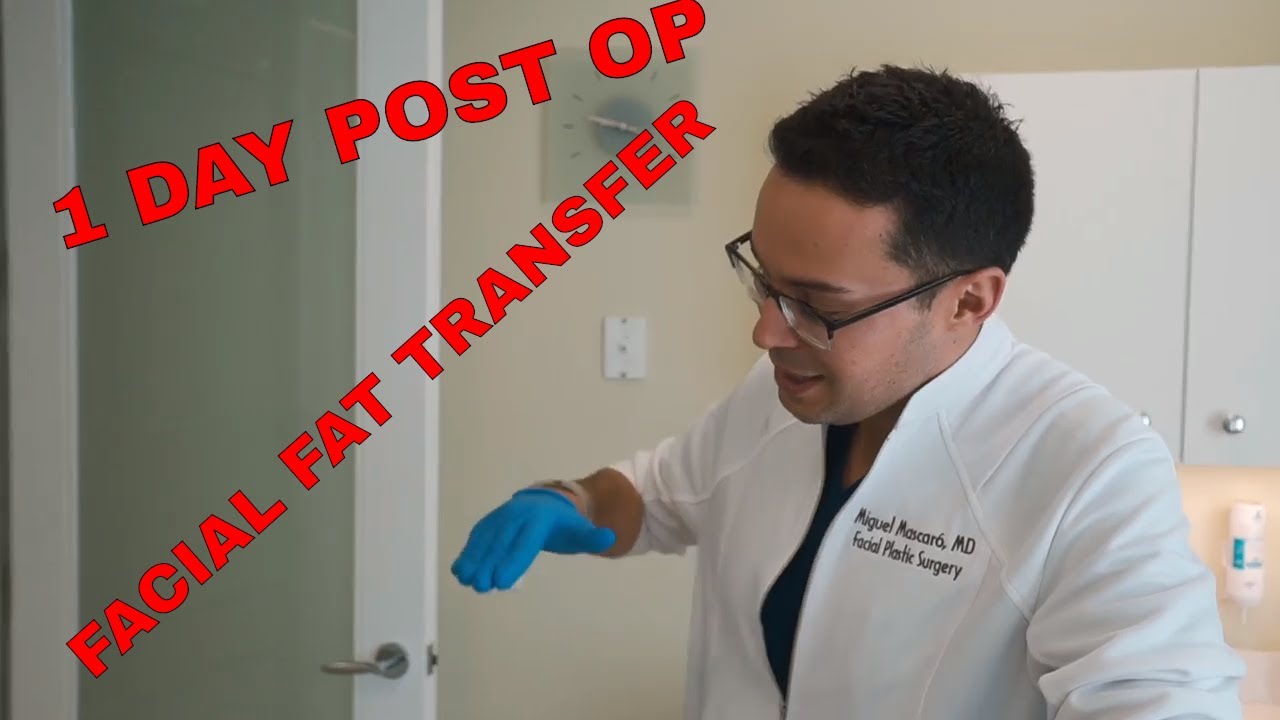 What happens 1 day after facial fat transfer?