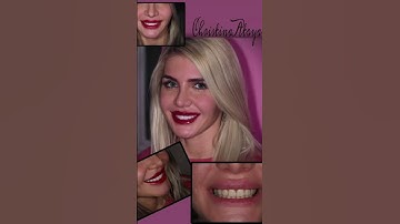 цирконо керамика Noritake CZR