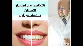 طريقة طبيعيه للتخلص من اصفرار الاسنان مع محلول آلفم bain de bouch د.عماد ميزاب