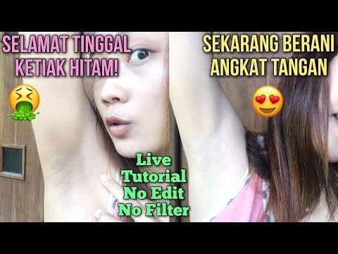 DR OZ - Tips Mengatasi Ketiak Gatal dan Hitam (25/2/18) Part 3. 