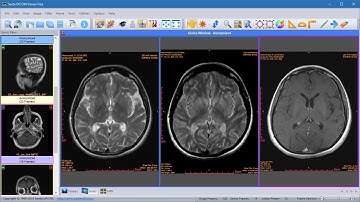 Sante DICOM Viewer - How to compare images of different series
