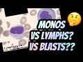 How to distinguish between Lymphocytes vs Monocytes