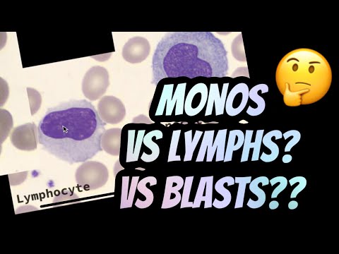 How to distinguish between Lymphocytes vs Monocytes