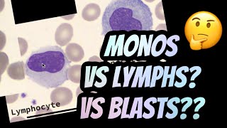 Différence entre les monocytes et les lymphocytes