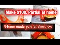 Acrylic Partial  Denture how is made For just $100 budget