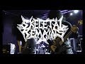 Skeletal Remains discusses Obituary, preserving old-school death metal sound and Devouring Mortality