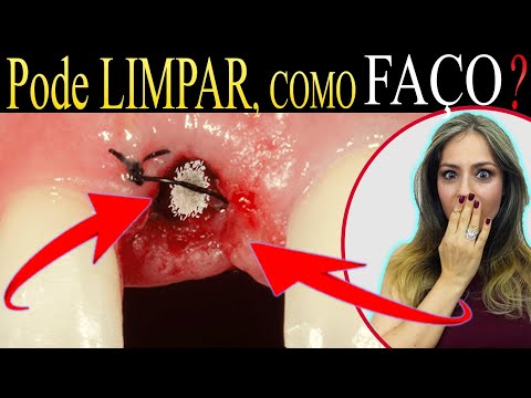 Vídeo: Como limpar alpercatas: 7 etapas (com fotos)