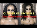 Battle of the Lace! Closure or Frontal| Relentless Beaute