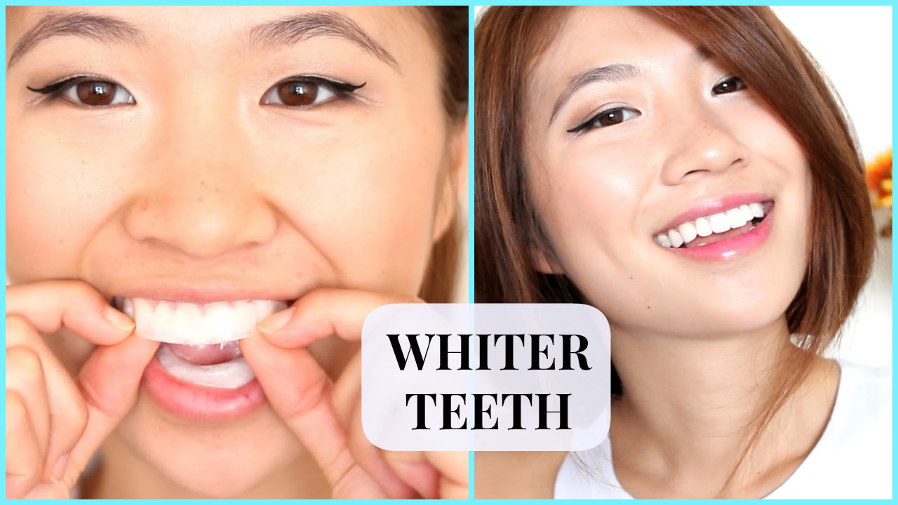 Teeth Whitening Routine at Home! Fast Results! - YouTube