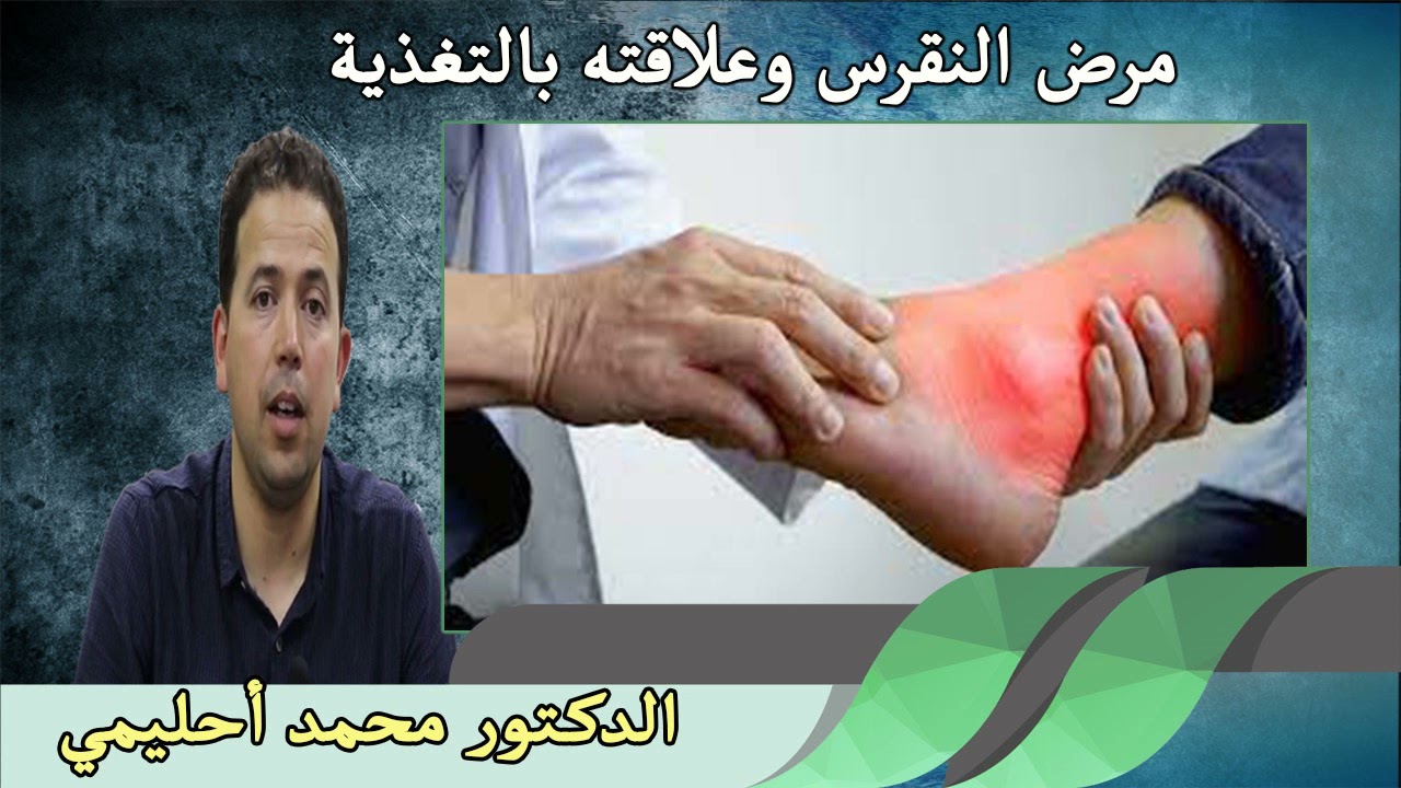مرض النقرس وعلاقته بالتغذية الدكتور محمد أحليمي