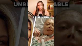 She Was Set On Fire By The Man She Loved Profile