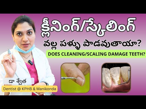 #1 Best Method to Clean Your Teeth without damage | Palla Gaara Povalante in Telugu | Platina Dental