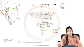 44. Cardiomyopathies | Internal Medicine Harrison Based | USMLE Step 2 CK : Dr Maithreyi Govind