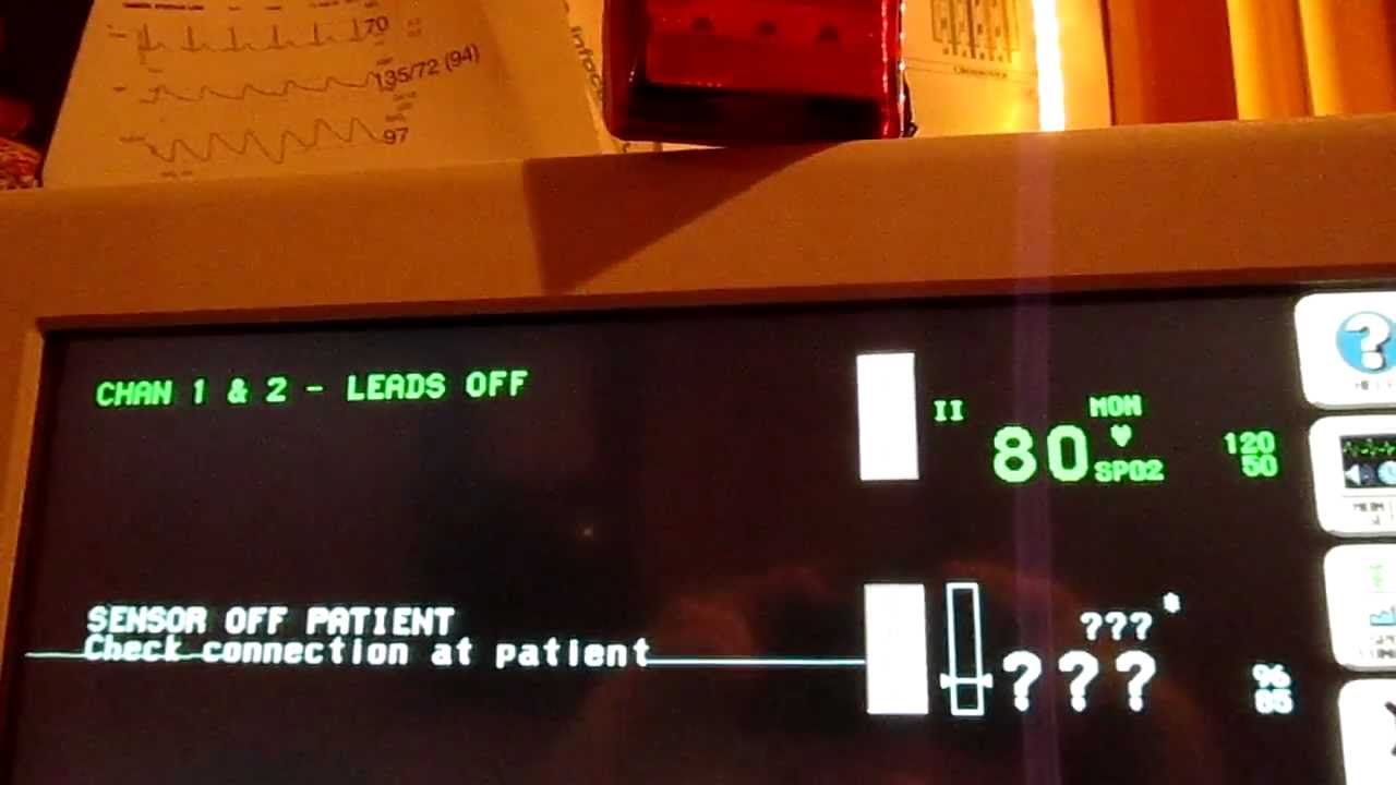 External alarm light for Spacelabs monitors (home made) - YouTube
