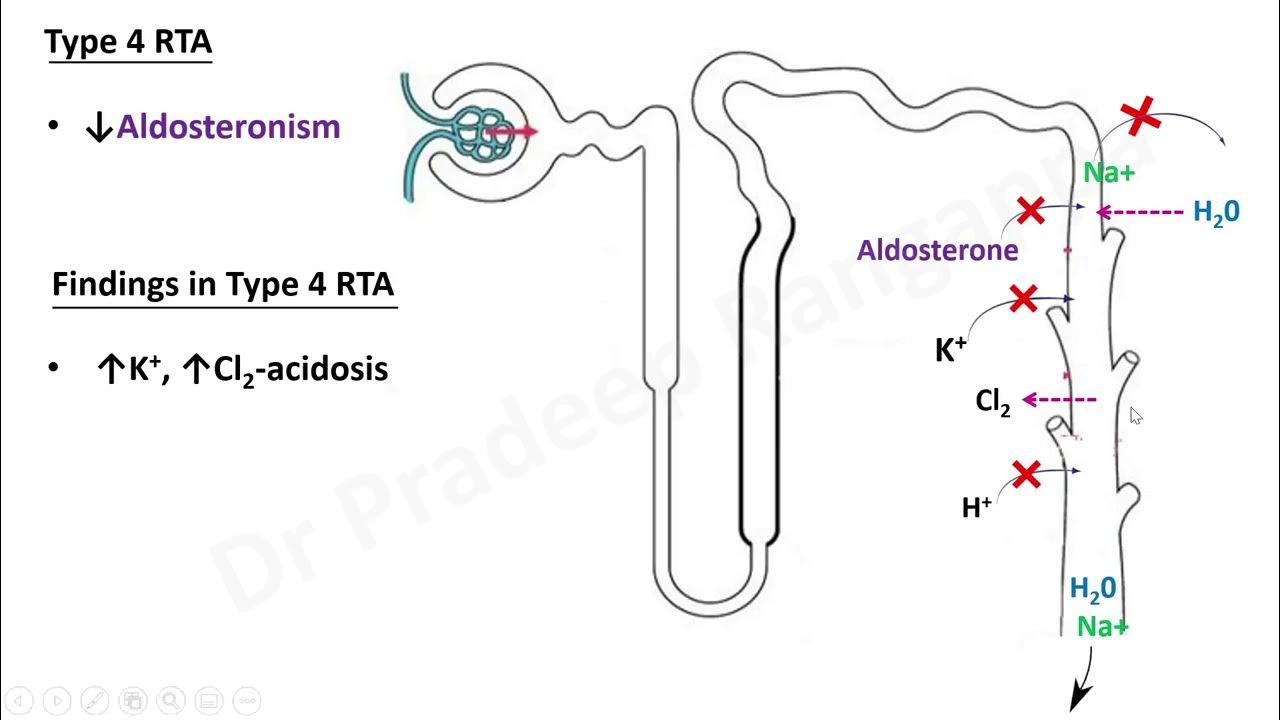 rta-renal-tubular-acidosis-youtube