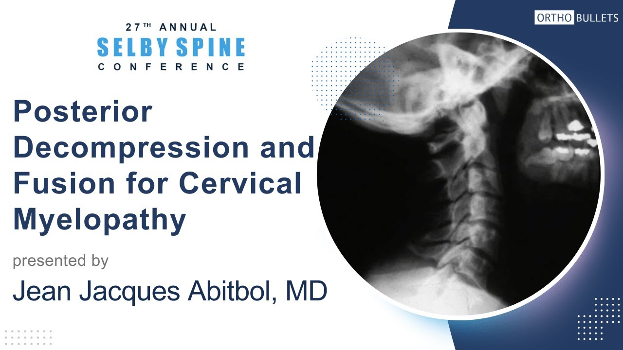 Posterior and Fusion for Cervical Myelopathy Jean