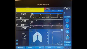 Mechanical Ventilation in Severe Airflow Obstruction