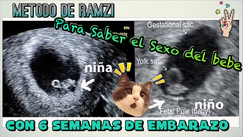 ¿Se puede saber si es niño o niña a las 6 semanas?