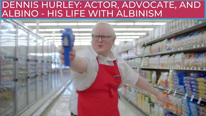 Dennis Hurley: Actor, Advocate, and Albino - His l...