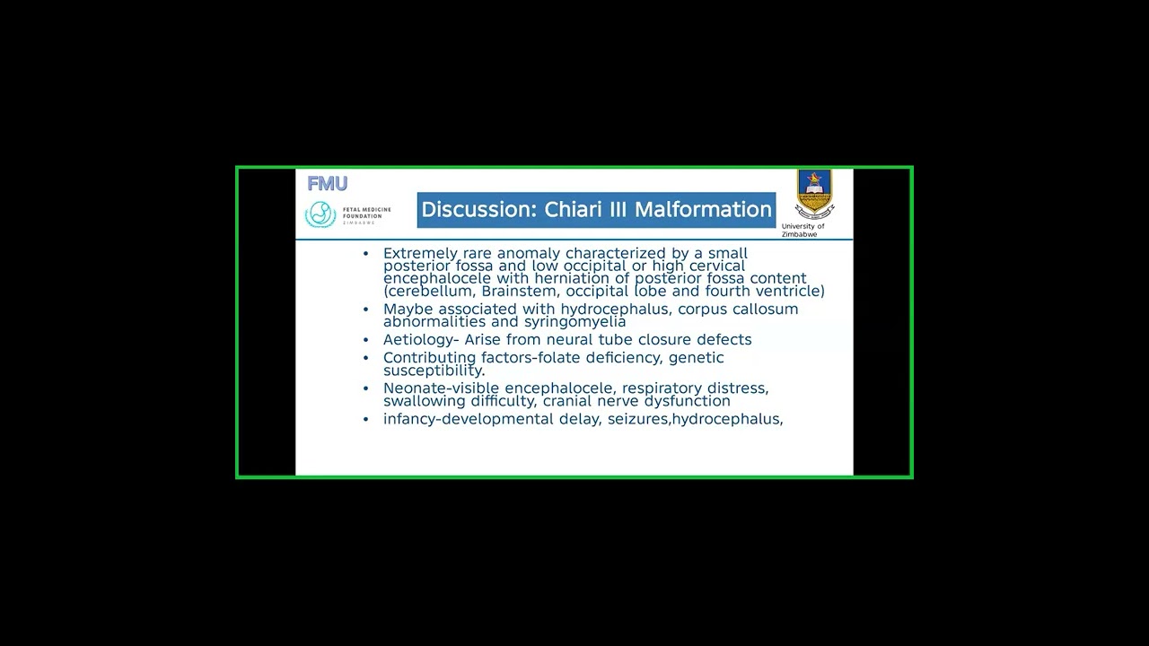 Chiari III Malformation: A case presentation of Encephalocele by Dr Mvundura
