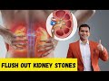 Dissolve  kidney stones naturally  flush out kidney stones  dr vivek joshi