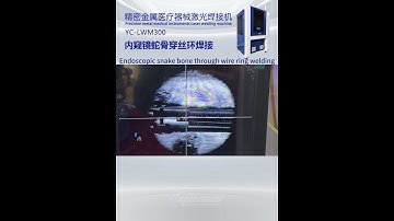 Endoscopic snake bone through wire ring welding