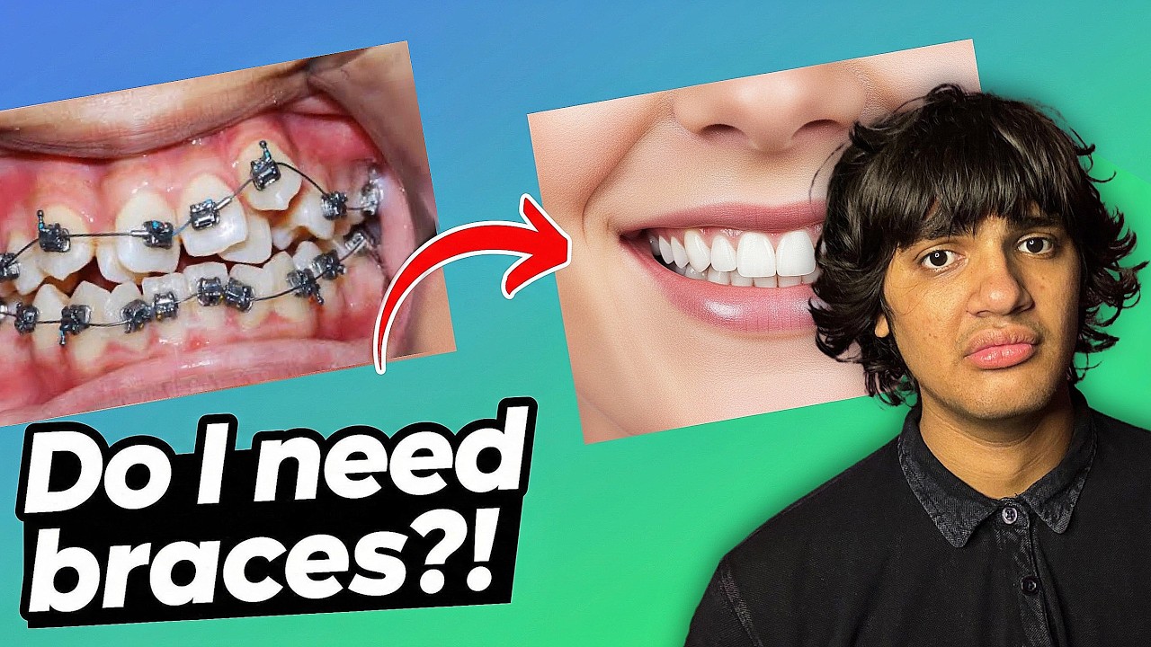 How To Tell If You Need BRACES! The ULTIMATE Braces Guide 🦷 - YouTube