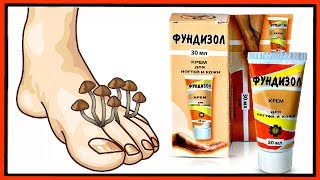 Грибок ногтей и Фундизол. Отвечаю НА ВАШИ вопросы. Лечу грибок ногтей.