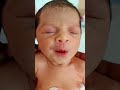 #baby #babychoice #cuteanimal #cutebaby #neonatologist #cute