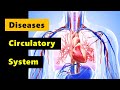 Circulatory System Diseases Quiz