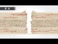 目で見る病気 第3版 VOL.16 骨・関節・軟部の疾患