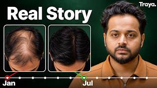 Download lagu What Finally Fixed My Hair Fall When Nothing Else Did