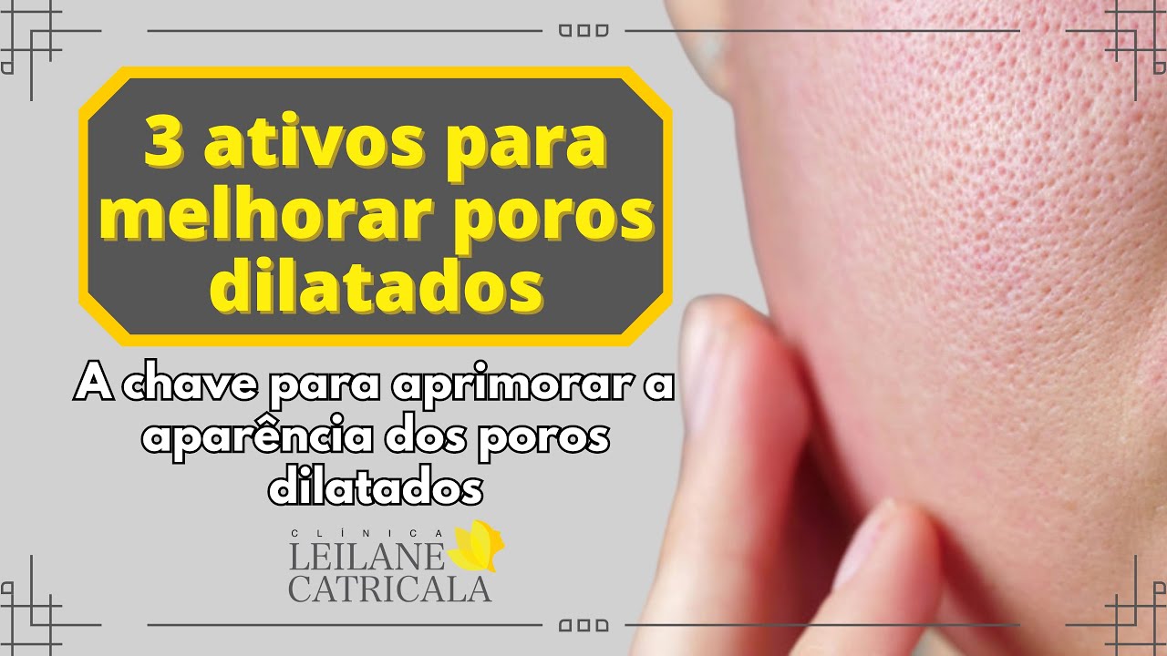 Como Reduzir Poros Dilatados? 3 Ativos Poderosos - YouTube
