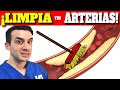 El INCREIBLE METODO que LIMPIA tus ARTERIAS RAPIDAMENTE! (Colesterol)