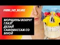 От морщин вокруг глаз