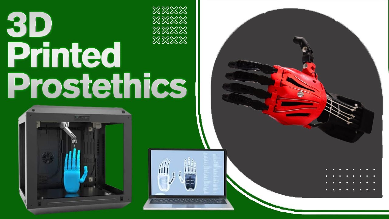 3D Printed Prosthetics Are Changing the World! (Arms, Hands, and Even Prosthetics for Animals)