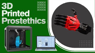 3D Printed Prosthetics Are Changing the World! (Arms, Hands, and Even Prosthetics for Animals)