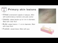 4. Primary and Secondary skin lesions