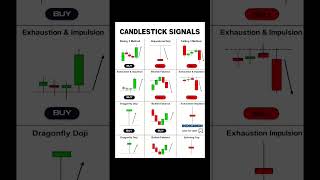 Powerful Candlestick Pattern for High Probability Entry || Gold || Trader Aditya #trading