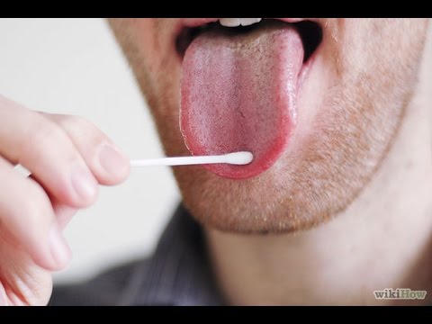 Vidéo: Comment personnaliser un protège-dents : 5 étapes