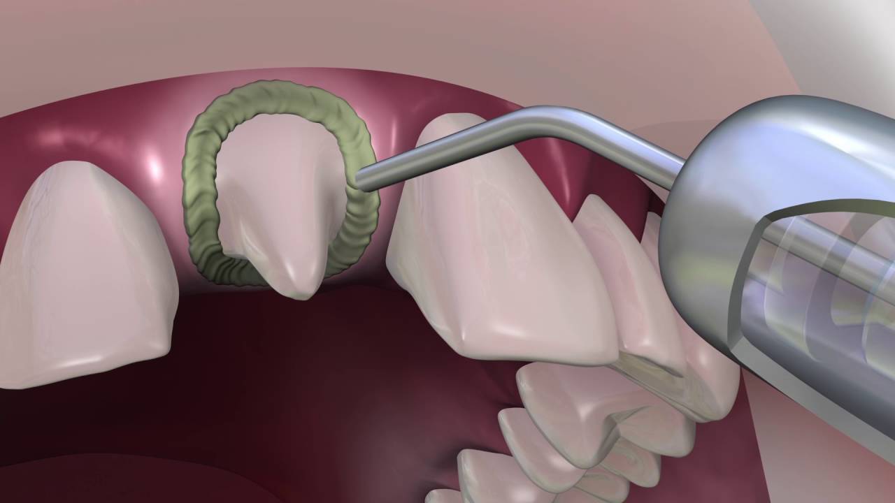 EXPASYL Promotional Video