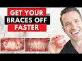 Orthodontist Explains The Secret to Getting Your Braces Off Faster | Dr. Nate