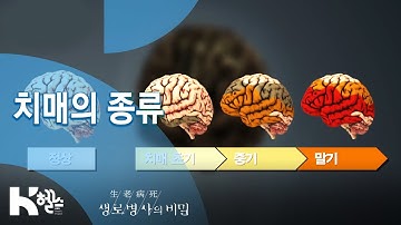 [생로병사의 비밀] 708회 핫클립? - 치매의 종류와 주요 증상?